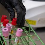 Blood samples being analysed in a medical laboratory