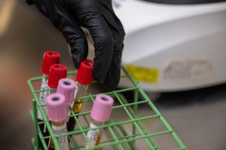 Blood samples being analysed in a medical laboratory